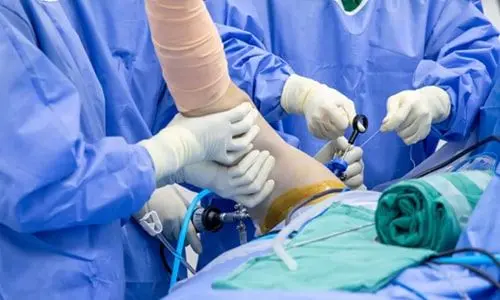 Ön Çapraz Bağ Kopması: Nedenleri, Tedavi Süreci ve İyileşme Dönemi